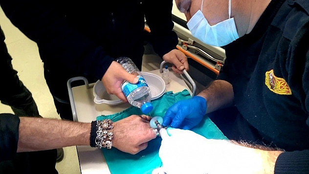 Şişen parmaklarında sıkışan yüzükleri itfaiye keserek çıkartabildi