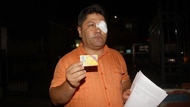 Fethiye'de gazeteciye saldırı
