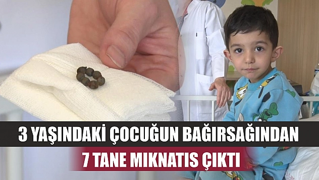 3 yaşındaki çocuğun bağırsağından 7 tane mıknatıs çıktı