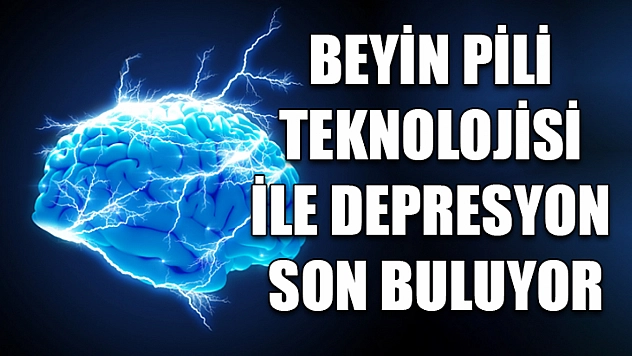 Beyin pili teknolojisi ile depresyon son buluyor