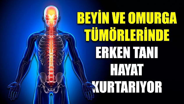 Beyin ve omurga tümörlerinde erken tanı hayat kurtarıyor