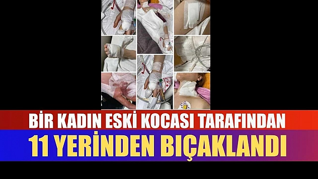 Bir kadın, eski kocası tarafından 11 yerinden bıçaklandı