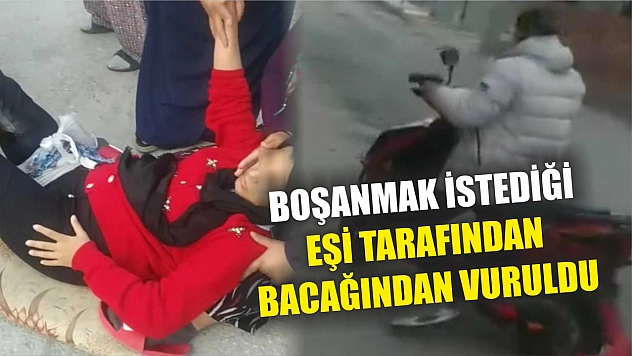 Boşanmak istediği eşi tarafından bacağından vuruldu