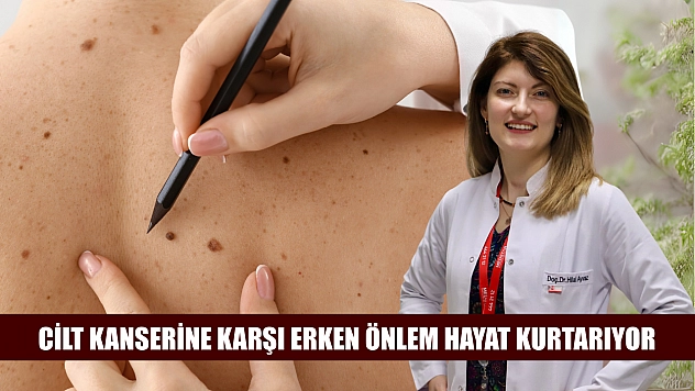 Cilt kanserine karşı erken önlem hayat kurtarıyor