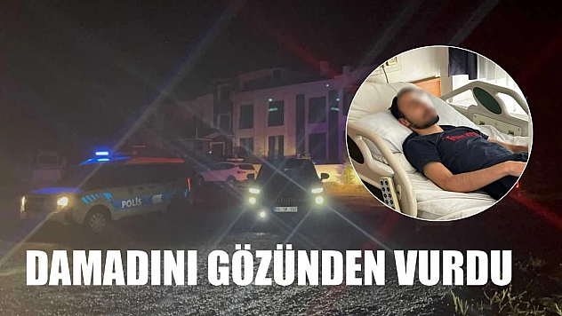 Damadını gözünden vurdu