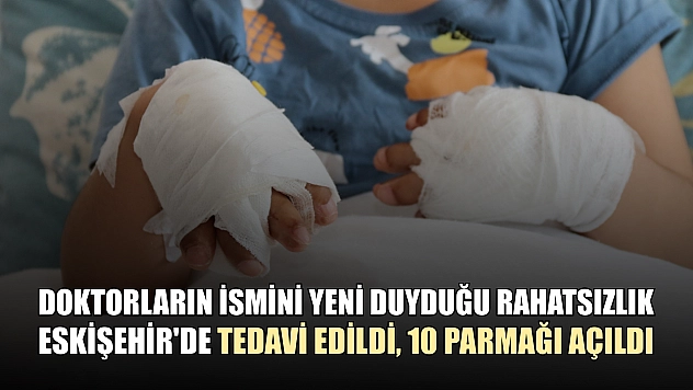 Doktorların ismini yeni duyduğu rahatsızlık Eskişehir'de tedavi edildi, 10 parmağı açıldı