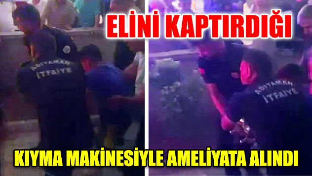 Elini Kaptırdığı Kıyma Makinesiyle Ameliyata Alındı