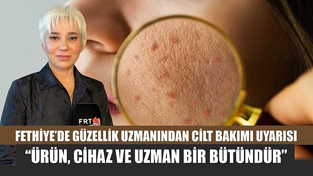 Fethiye'de Güzellik Uzmanından cilt bakımı uyarısı: 'Ürün, cihaz ve uzman bir bütündür'