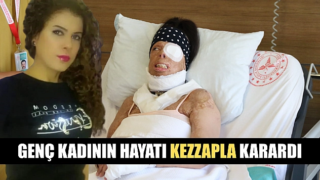 Genç kadının hayatı kezzapla karardı