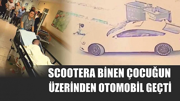 Scootera binen çocuğun üzerinden otomobil geçti