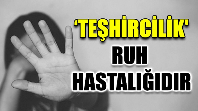'Teşhircilik' Ruh Hastalığıdır