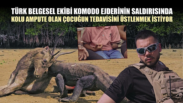Türk belgesel ekibi komodo ejderinin saldırısında kolu ampute olan çocuğun tedavisini üstlenmek istiyor