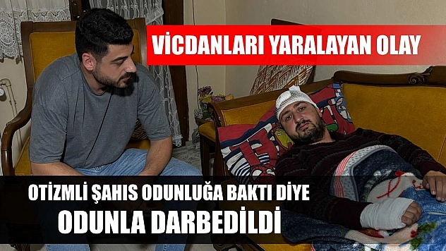 Vicdanları yaralayan olay: Otizmli şahıs odunluğa baktı diye odunla darbedildi