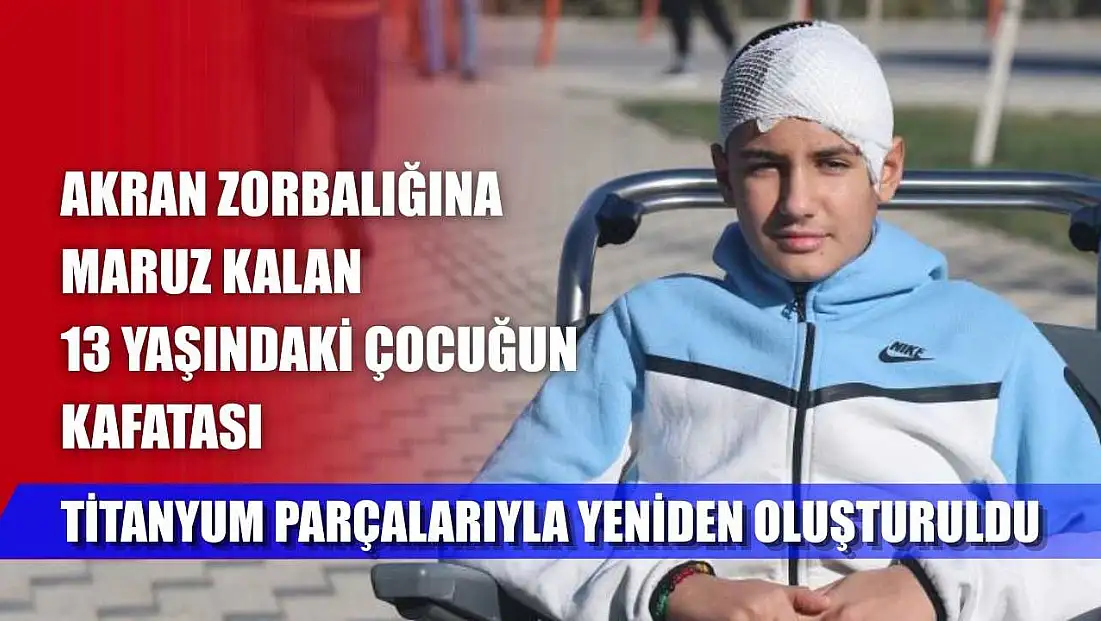 Akran zorbalığına maruz kalan 13 yaşındaki çocuğun kafatası titanyum parçalarıyla yeniden oluşturuldu