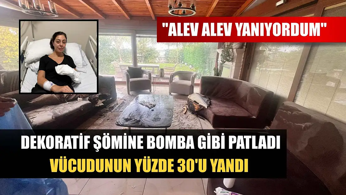 Dekoratif şömine bomba gibi patladı, vücudunun yüzde 30'u yandı: 'Alev alev yanıyordum'