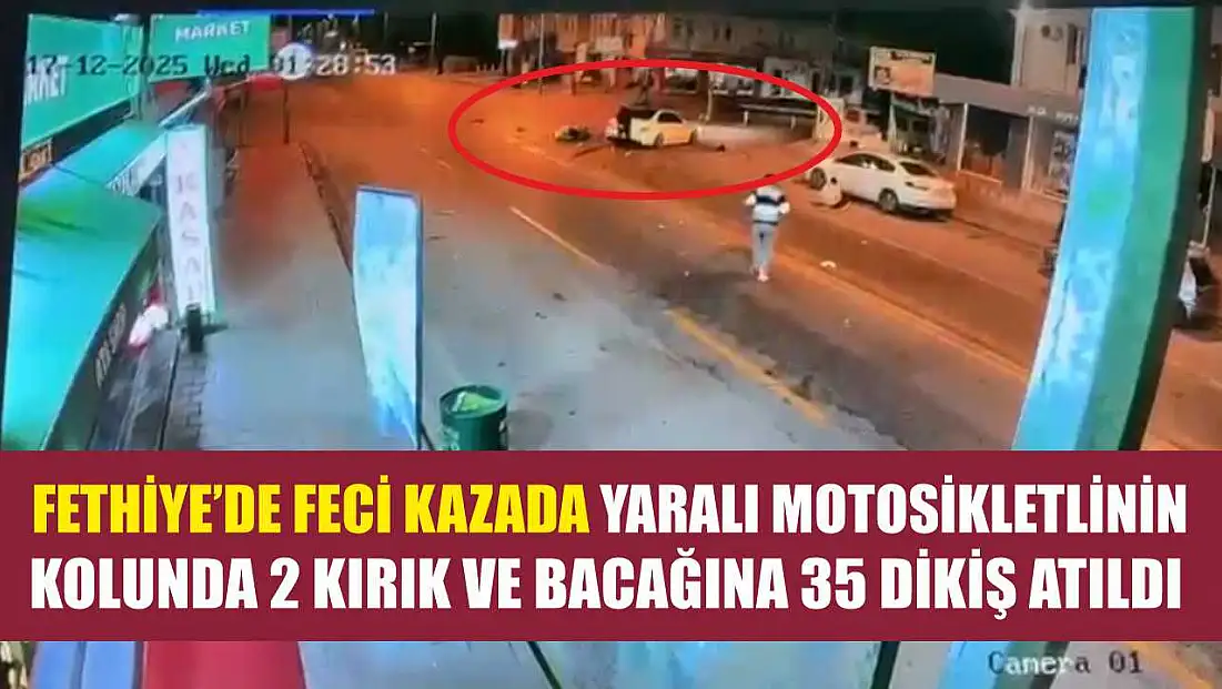 Fethiye’de feci kazada yaralı motosikletlinin kolunda 2 kırık ve bacağına 35 dikiş atıldı