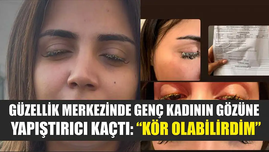 Güzellik merkezinde genç kadının gözüne yapıştırıcı kaçtı: 'Kör olabilirdim'