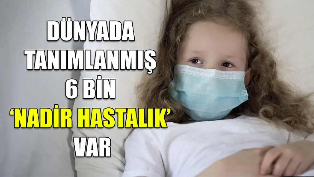 Dünyada tanımlanmış 6 bin ‘Nadir Hastalık’ var