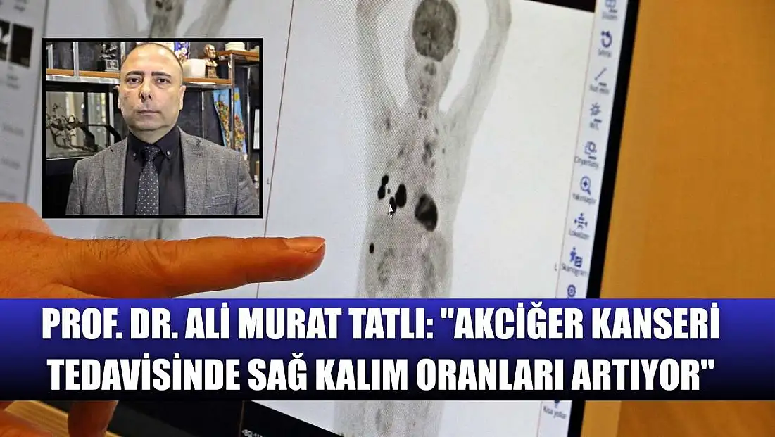 Prof. Dr. Ali Murat Tatlı: 'Akciğer kanseri tedavisinde sağ kalım oranları artıyor'