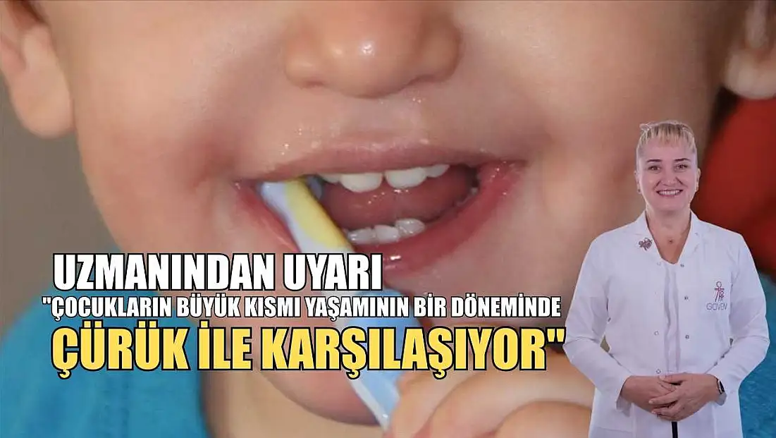 Uzmanından uyarı: 'Çocukların büyük kısmı yaşamının bir döneminde çürük ile karşılaşıyor'