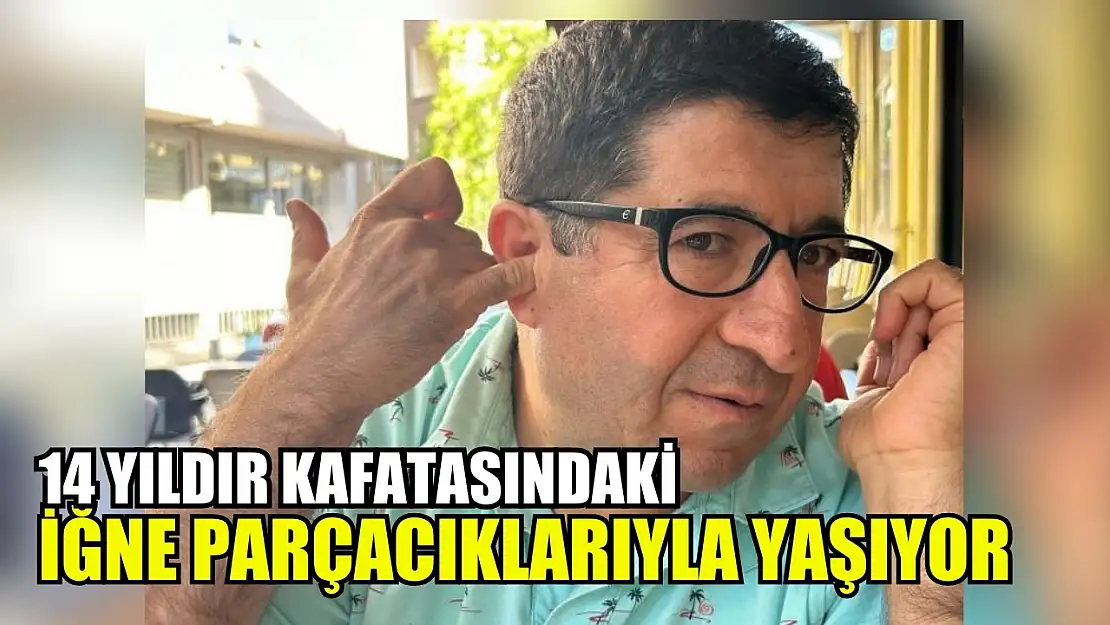 14 yıldır kafatasındaki iğne parçacıklarıyla yaşıyor