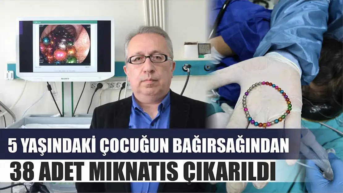 5 yaşındaki çocuğun bağırsağından 38 adet mıknatıs çıkarıldı