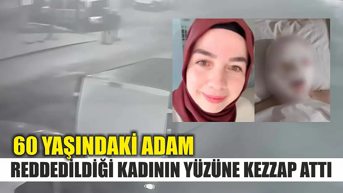 60 yaşındaki adam, reddedildiği kadının yüzüne kezzap attı