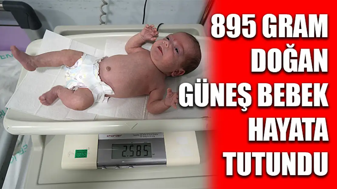 895 gram doğan Güneş bebek hayata tutundu