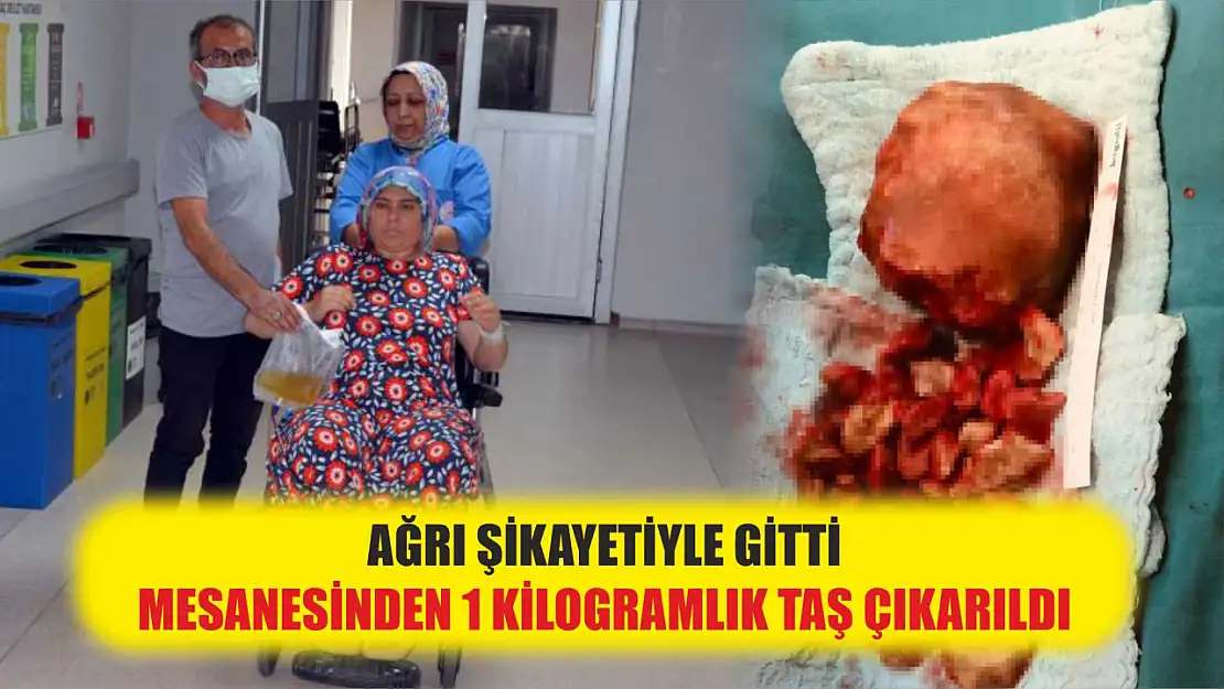 Ağrı şikayetiyle gitti, mesanesinden 1 kilogramlık taş çıkarıldı