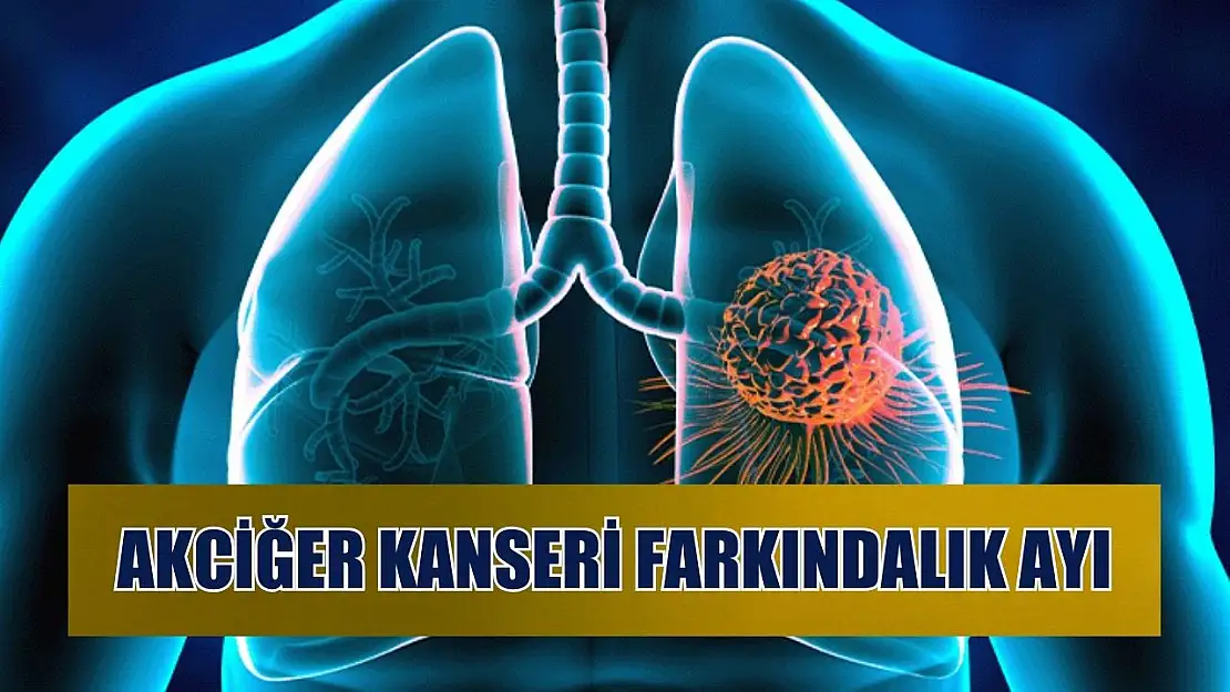 Akciğer Kanseri Farkındalık Ayı