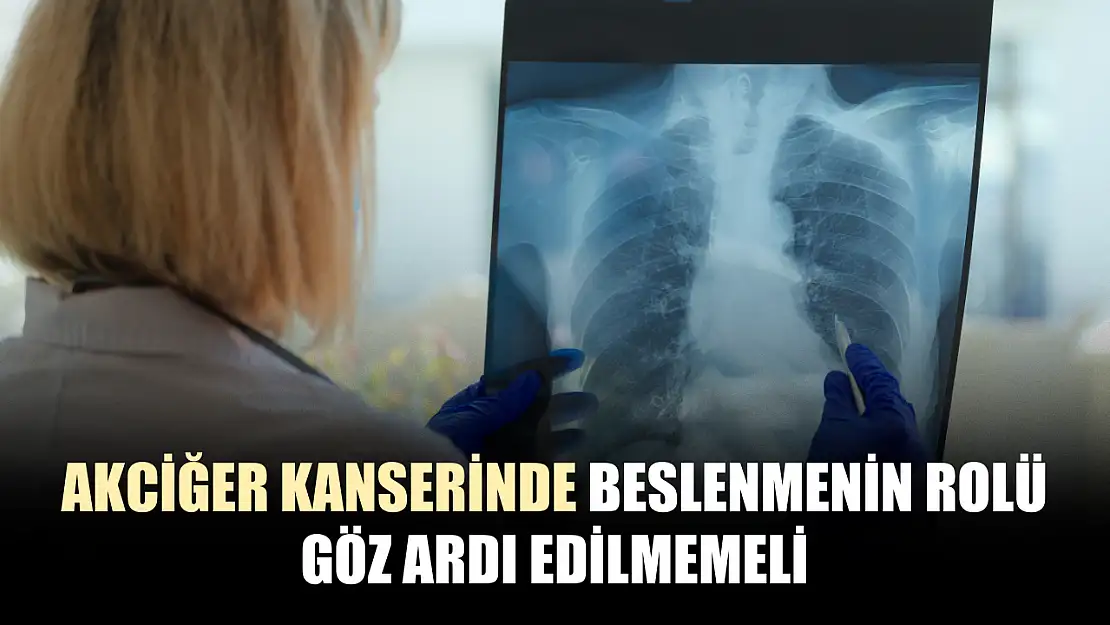 Akciğer kanserinde beslenmenin rolü göz ardı edilmemeli