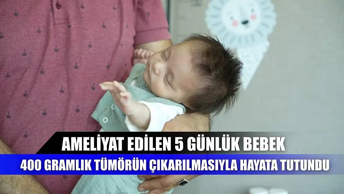 Ameliyat edilen 5 günlük bebek, 400 gramlık tümörün çıkarılmasıyla hayata tutundu