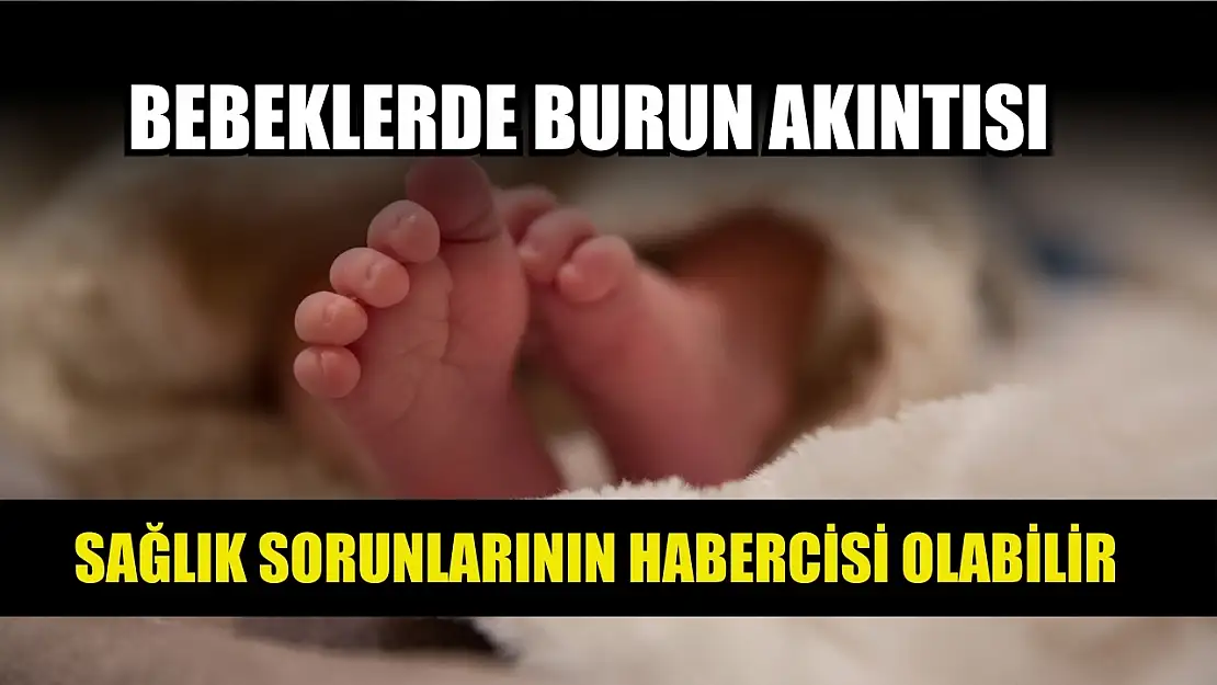 Bebeklerde burun akıntısı, sağlık sorunlarının habercisi olabilir