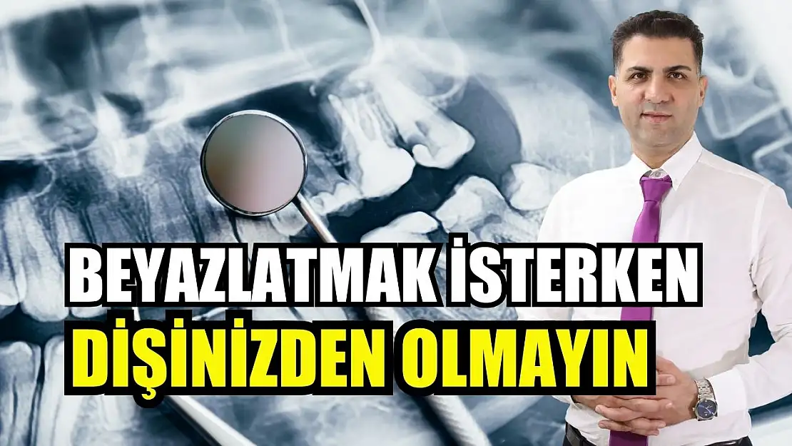 Beyazlatmak isterken dişinizden olmayın