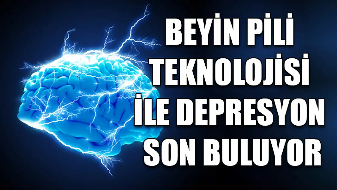 Beyin pili teknolojisi ile depresyon son buluyor