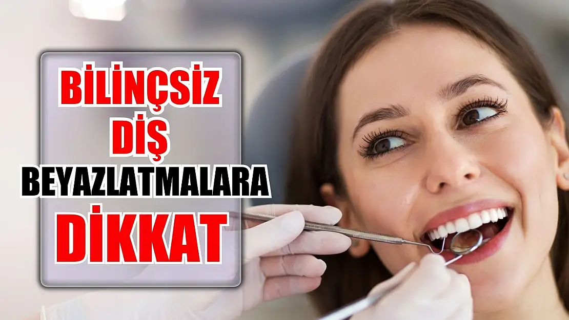 Bilinçsiz diş beyazlatmalara dikkat