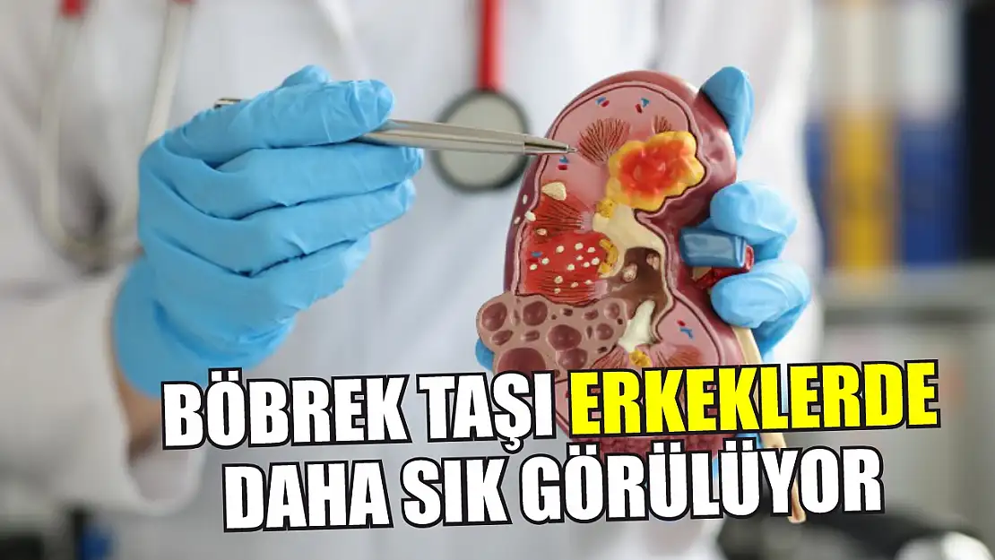 Böbrek taşı erkeklerde daha sık görülüyor