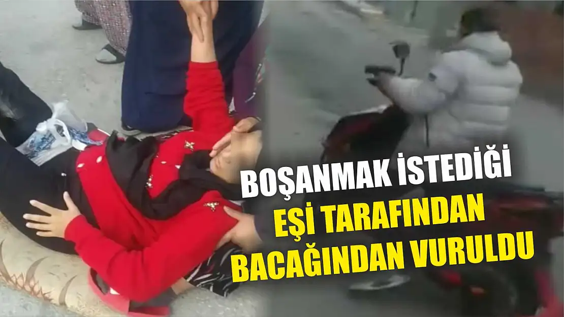 Boşanmak istediği eşi tarafından bacağından vuruldu