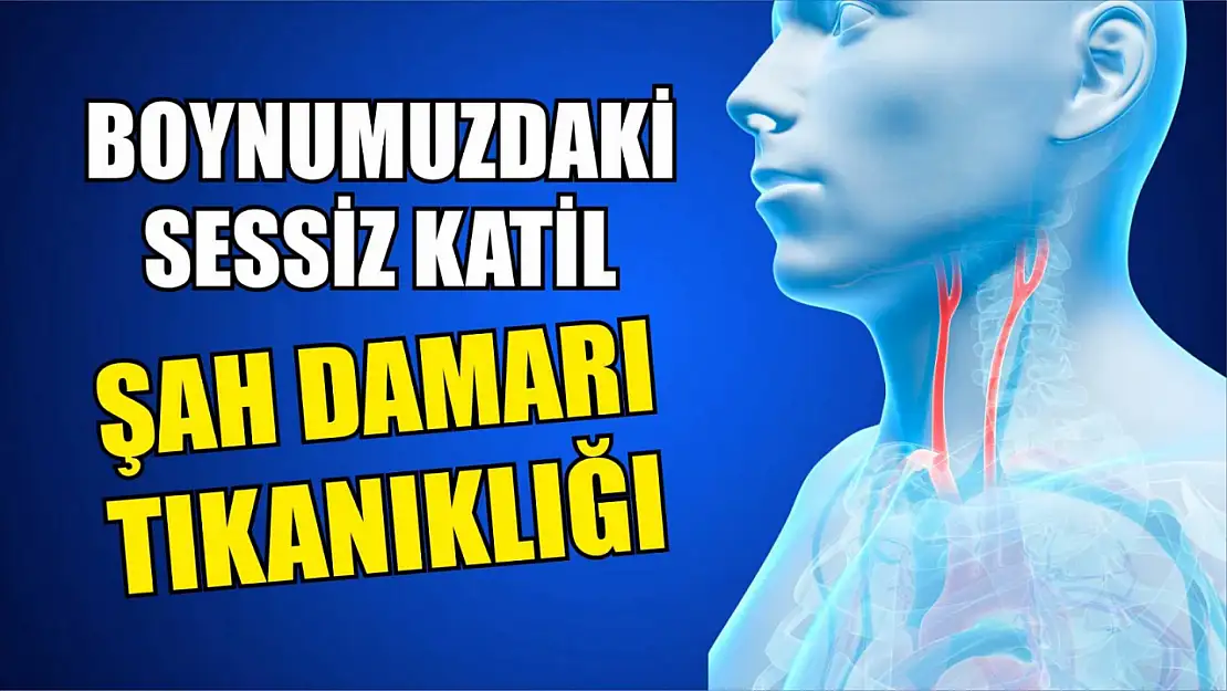 Boynumuzdaki Sessiz Katil: Şah Damarı Tıkanıklığı