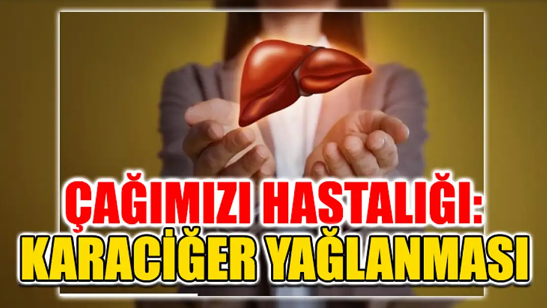 Çağımızın Hastalığı: Karaciğer Yağlanması