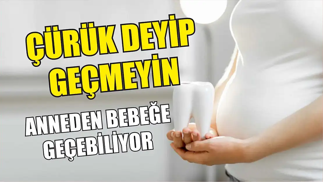 Çürük Deyip Geçmeyin Anneden Bebeğe Geçebiliyor