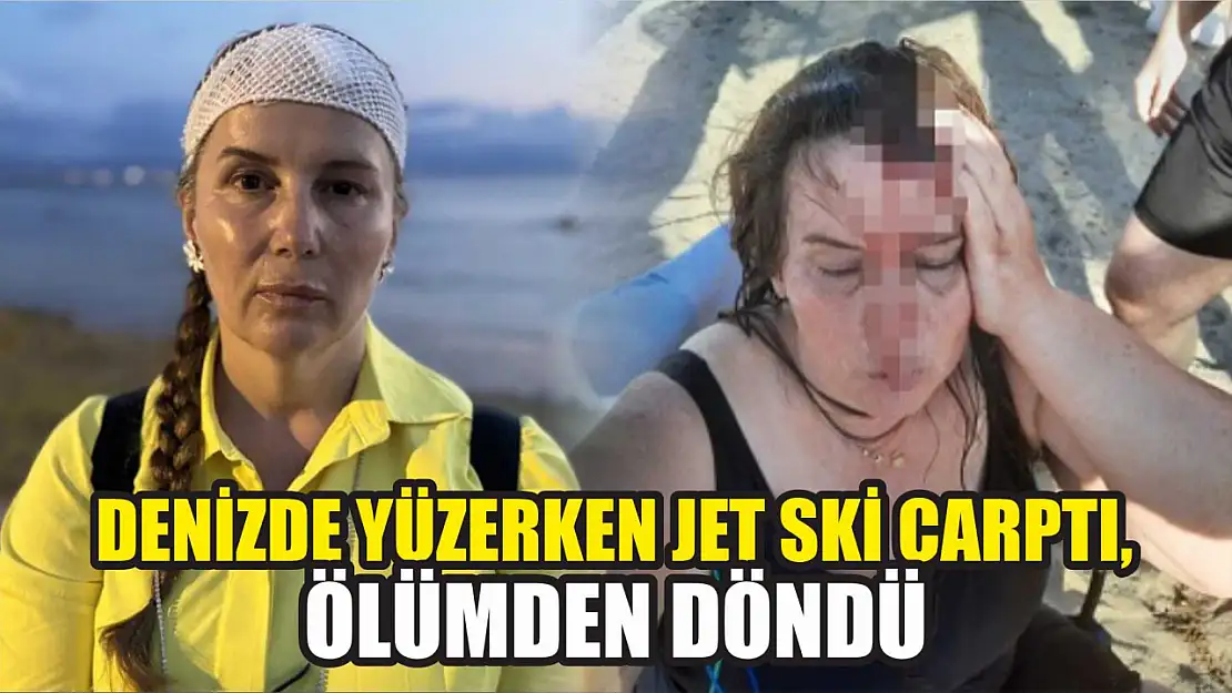 Denizde yüzerken jet ski çarptı, ölümden döndü