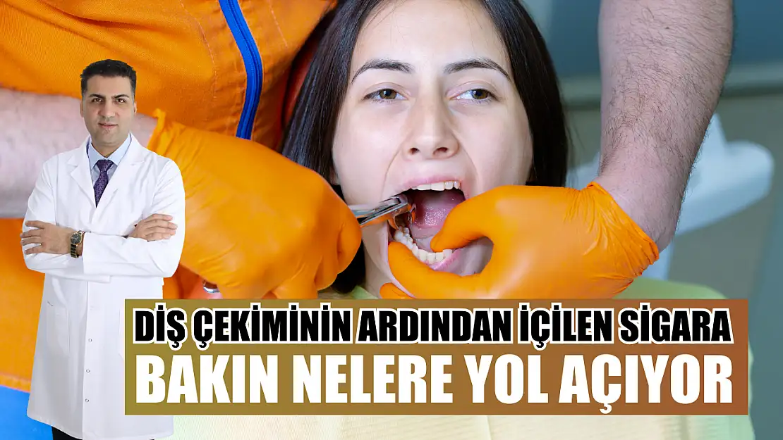 Diş çekiminin ardından içilen sigara bakın nelere yol açıyor