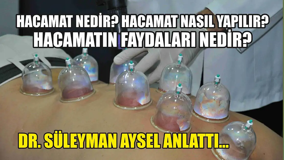 Dr. Süleyman Aysel anlattı…  Hacamat nedir? Hacamat nasıl yapılır? Hacamatın faydaları nedir?