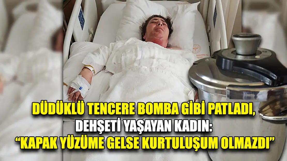 Düdüklü tencere bomba gibi patladı, dehşeti yaşayan kadın: 'Kapak yüzüme gelse kurtuluşum olmazdı'