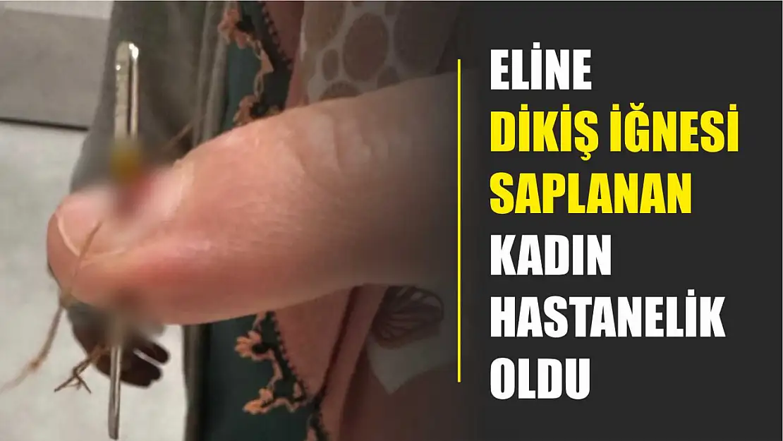 Eline dikiş iğnesi saplanan kadın hastanelik oldu