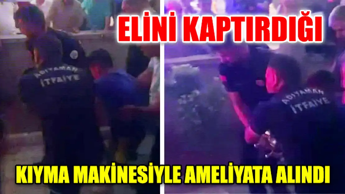 Elini Kaptırdığı Kıyma Makinesiyle Ameliyata Alındı