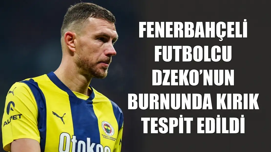 Fenerbahçeli futbolcu Dzeko'nun burnunda kırık tespit edildi