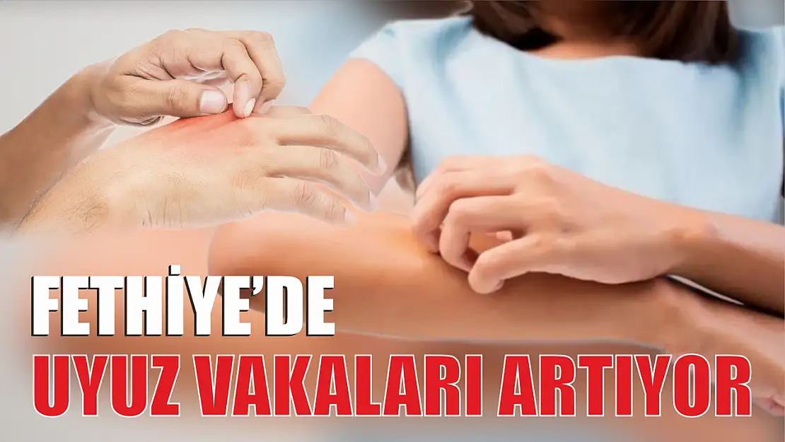 Fethiye'de Uyuz Vakaları Artıyor 