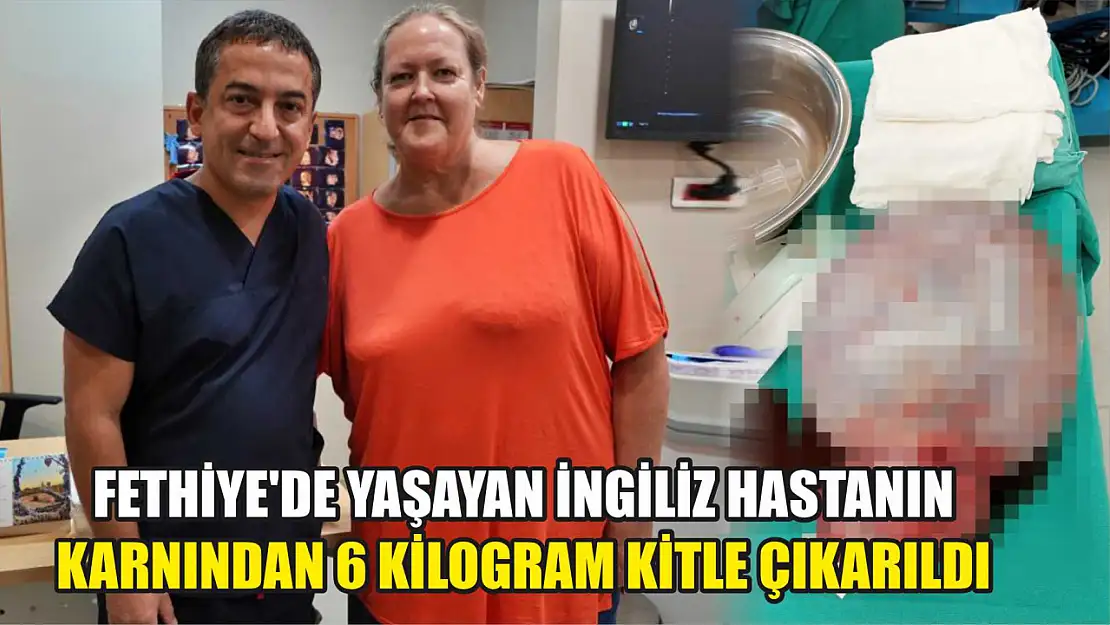 Fethiye'de yaşayan İngiliz hastanın karnından 6 kilogram kitle çıkarıldı